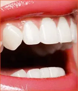 牙周诊疗详细介绍 39