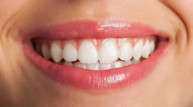 曲靖牙齿矫正咨询解答-哪些牙齿需要矫正？ 5