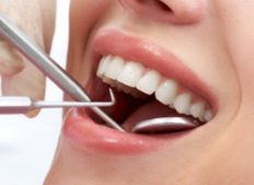 牙齿开颌牙不矫正会有什么后果？注意导致产生颌骨畸形 7