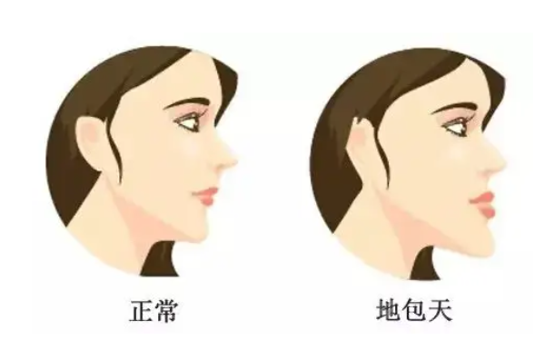 地包天有必要矫正吗？附牙齿矫正项目收费价格 1