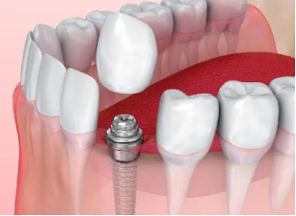大连齿医生口腔门诊种植牙怎么样？一家大型牙科品质值得信赖 5